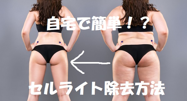 セルライト除去方法